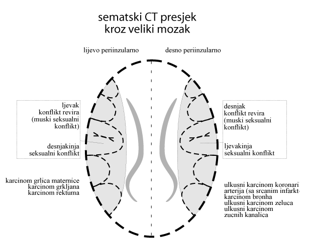 Schema Cortex